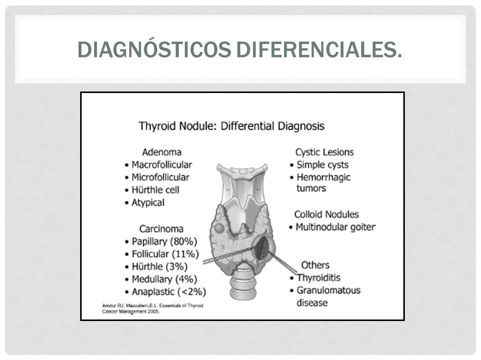 Diagnósticos Diferenciales.