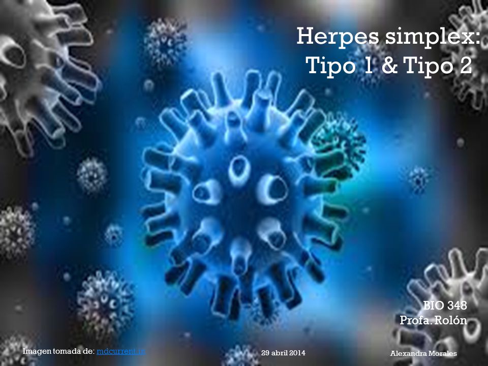 Herpes simplex: Tipo 1 & Tipo 2