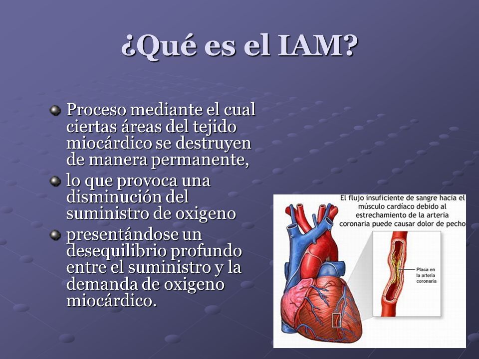 ¿Qué es el IAM Proceso mediante el cual ciertas áreas del tejido miocárdico se destruyen de manera permanente,