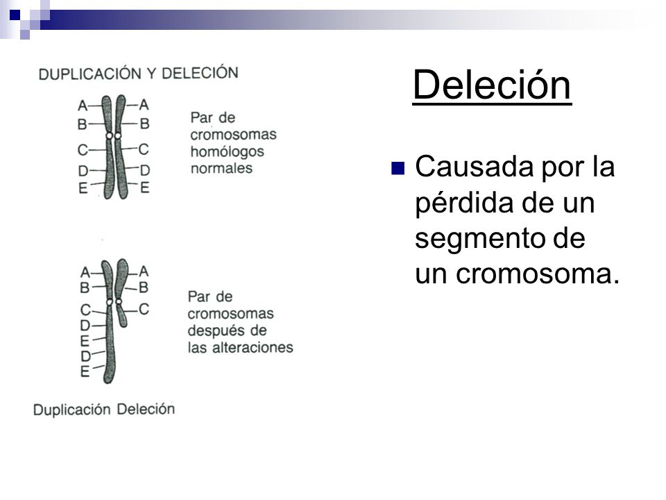 Deleción Causada por la pérdida de un segmento de un cromosoma.