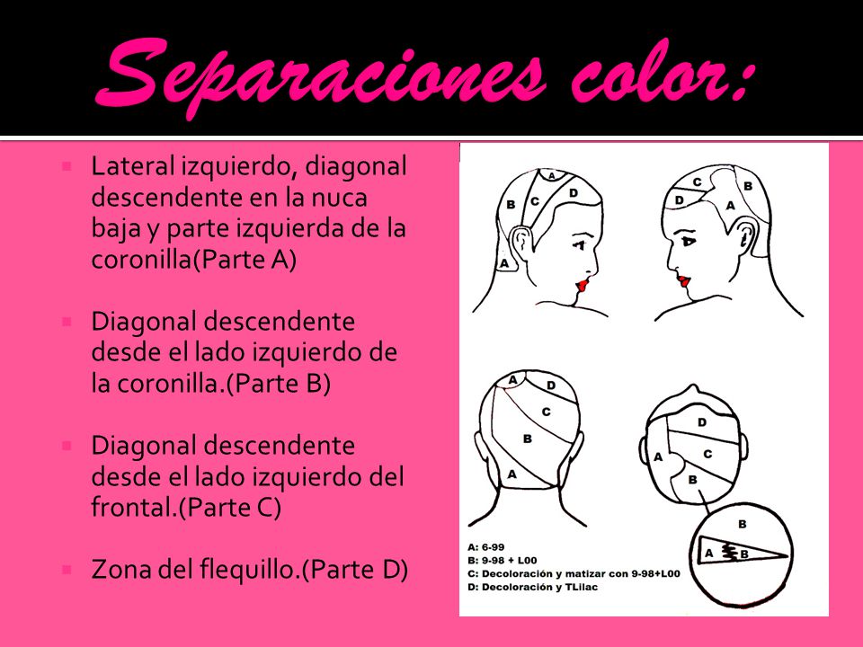 Separaciones color: Lateral izquierdo, diagonal descendente en la nuca baja y parte izquierda de la coronilla(Parte A)