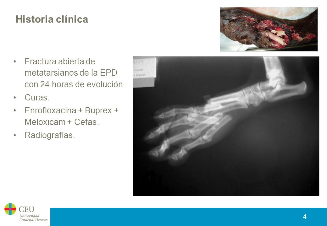 Historia clínica Fractura abierta de metatarsianos de la EPD con 24 horas de evolución. Curas. Enrofloxacina + Buprex + Meloxicam + Cefas.