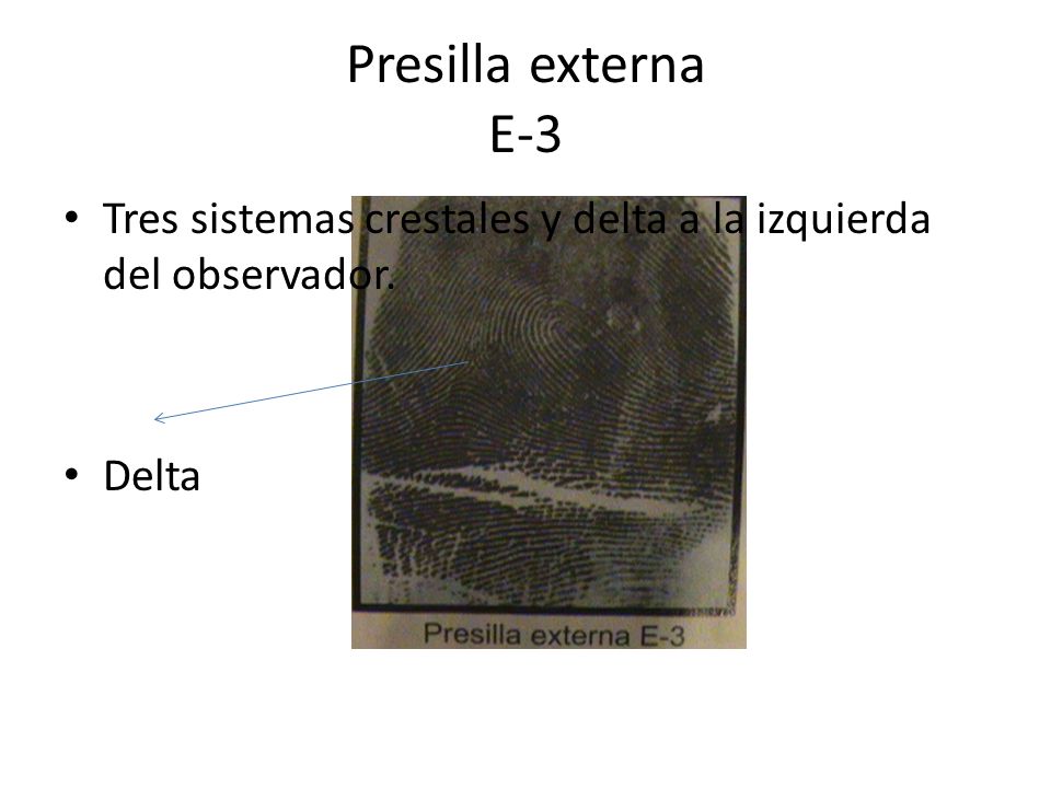 Presilla externa E-3 Tres sistemas crestales y delta a la izquierda del observador. Delta