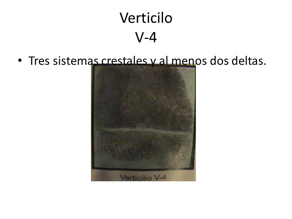 Verticilo V-4 Tres sistemas crestales y al menos dos deltas.