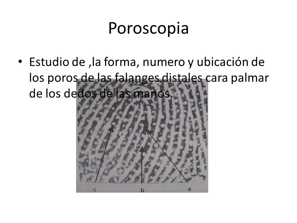 Poroscopia Estudio de ,la forma, numero y ubicación de los poros de las falanges distales cara palmar de los dedos de las manos.
