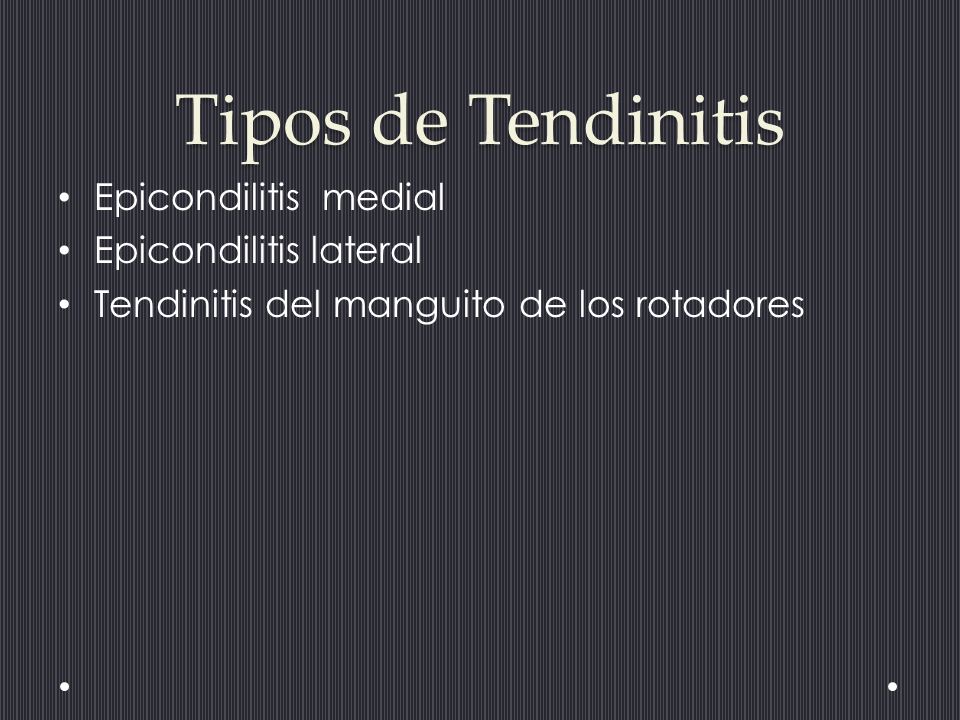 Tipos de Tendinitis Epicondilitis medial Epicondilitis lateral
