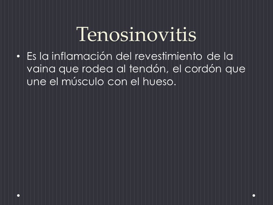 Tenosinovitis Es la inflamación del revestimiento de la vaina que rodea al tendón, el cordón que une el músculo con el hueso.