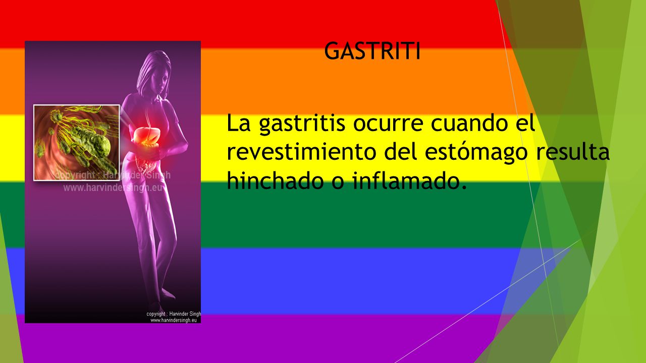 GASTRITI La gastritis ocurre cuando el revestimiento del estómago resulta hinchado o inflamado.