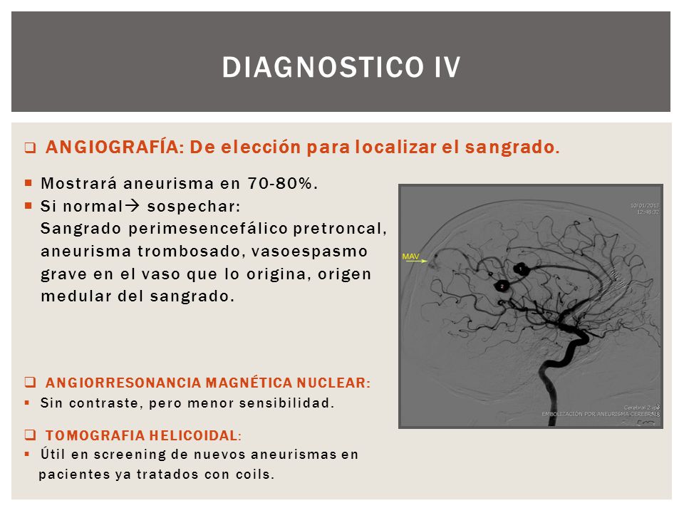 Diagnostico iv Mostrará aneurisma en 70-80%. Si normal sospechar: