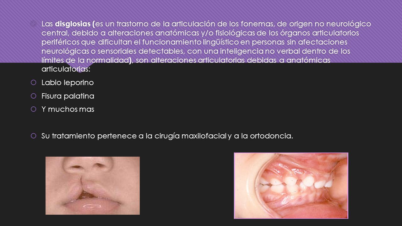 Las disglosias (es un trastorno de la articulación de los fonemas, de origen no neurológico central, debido a alteraciones anatómicas y/o fisiológicas de los órganos articulatorios periféricos que dificultan el funcionamiento lingüístico en personas sin afectaciones neurológicas o sensoriales detectables, con una inteligencia no verbal dentro de los límites de la normalidad), son alteraciones articulatorias debidas a anatómicas articulatorias: