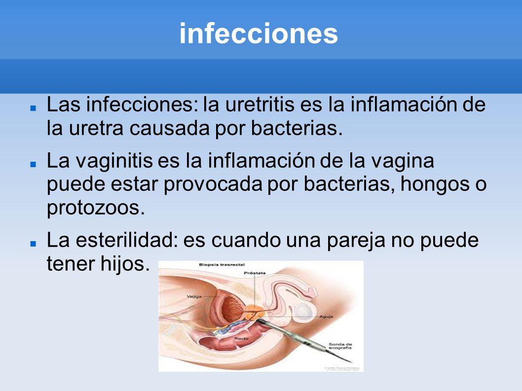 infecciones Las infecciones: la uretritis es la inflamación de la uretra causada por bacterias.