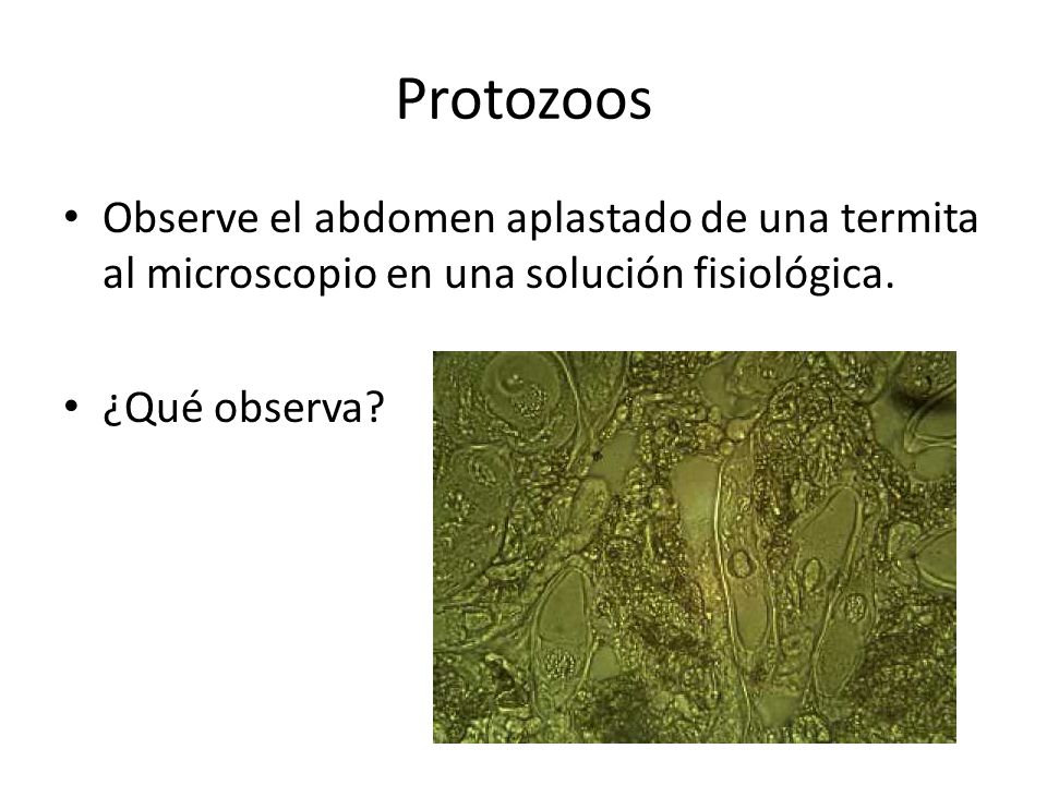 Protozoos Observe el abdomen aplastado de una termita al microscopio en una solución fisiológica.