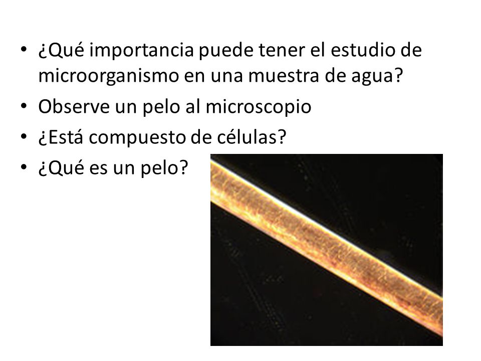 ¿Qué importancia puede tener el estudio de microorganismo en una muestra de agua
