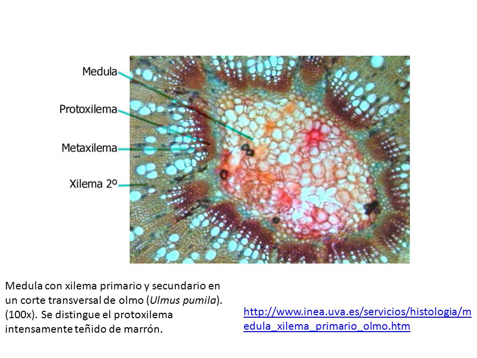 Medula con xilema primario y secundario en un corte transversal de olmo (Ulmus pumila). (100x). Se distingue el protoxilema intensamente teñido de marrón.