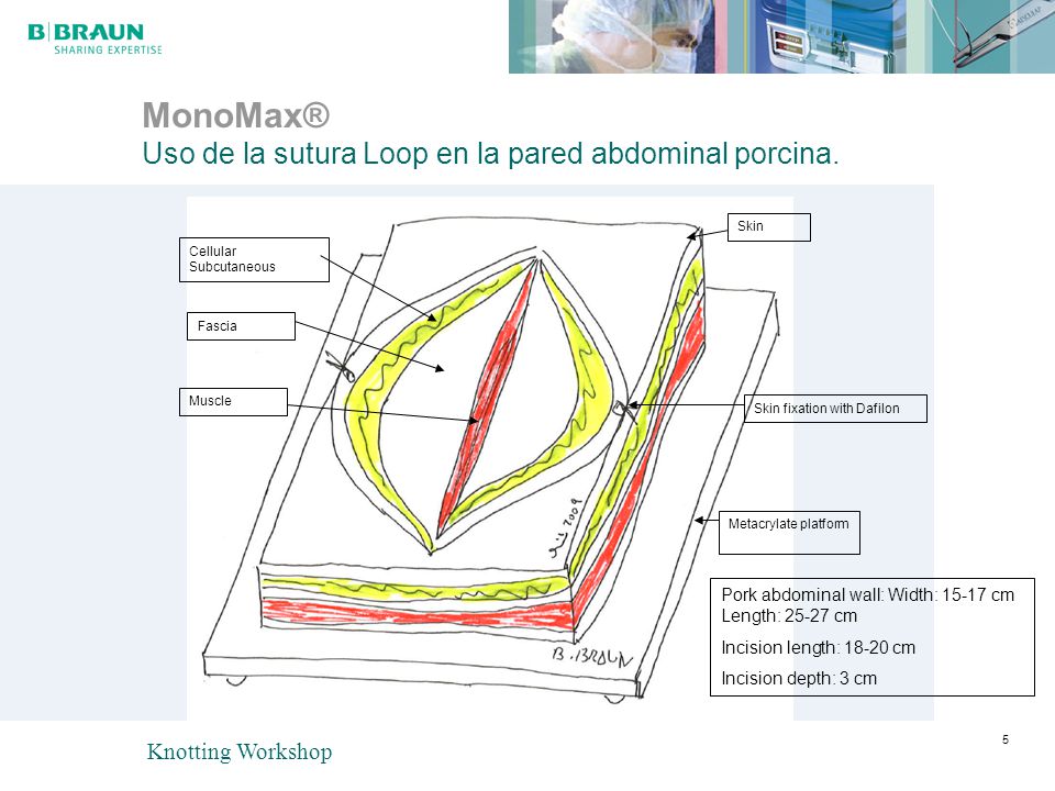 MonoMax® Uso de la sutura Loop en la pared abdominal porcina.