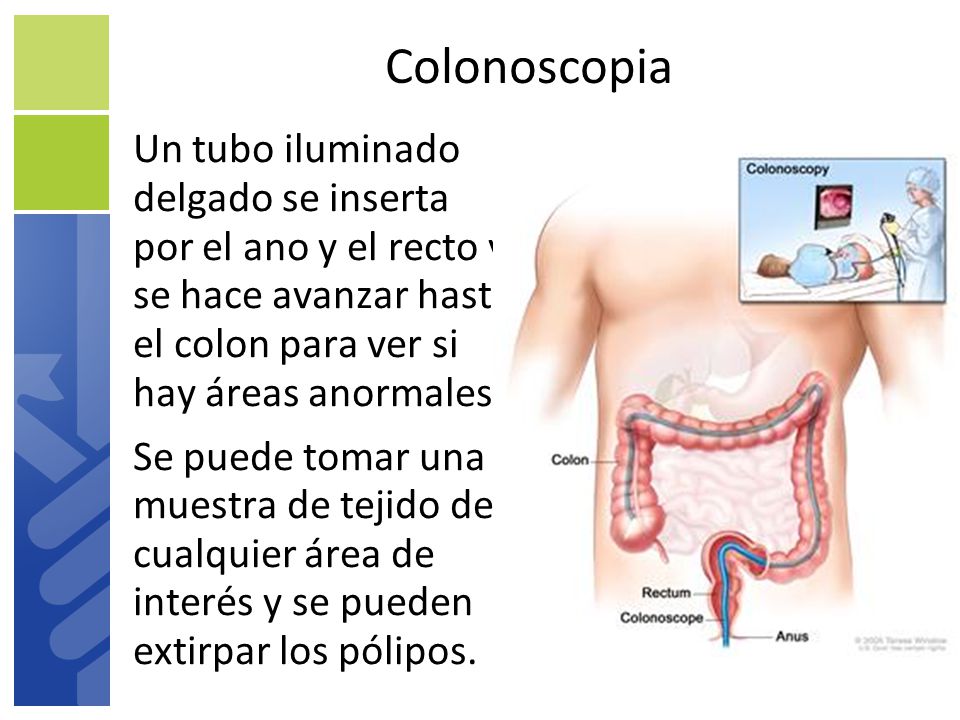 Colonoscopia