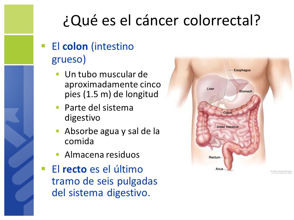 ¿Qué es el cáncer colorrectal