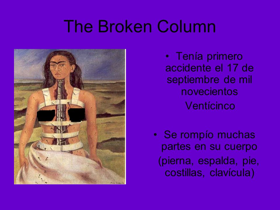 The Broken Column Tenía primero accidente el 17 de septiembre de mil novecientos. Ventícinco. Se rompío muchas partes en su cuerpo.