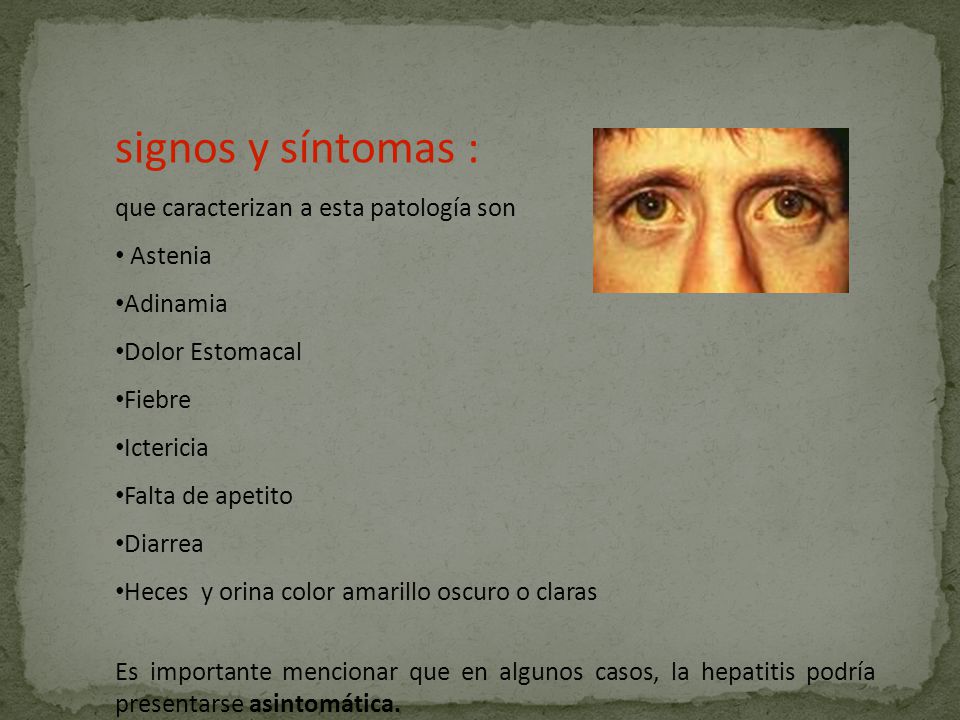 signos y síntomas : que caracterizan a esta patología son Astenia