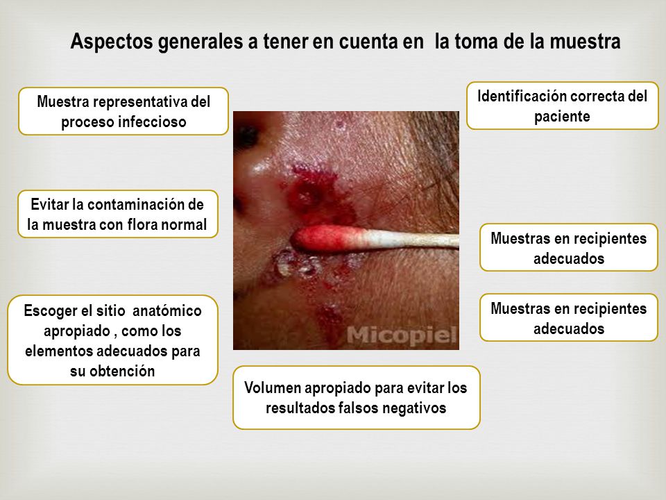 Aspectos generales a tener en cuenta en la toma de la muestra