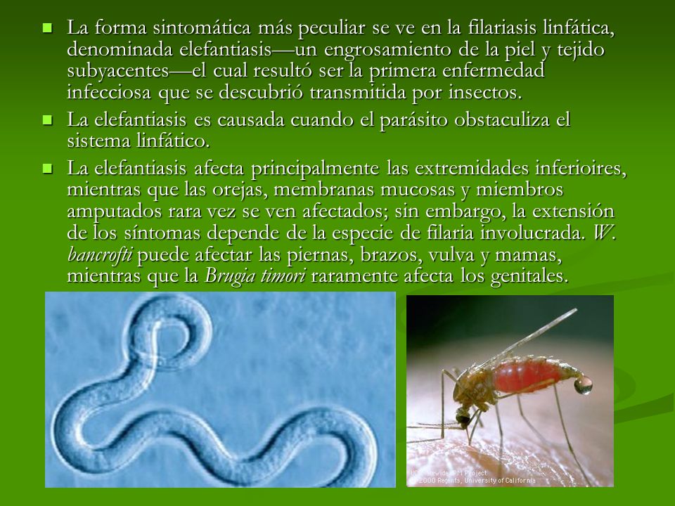 La forma sintomática más peculiar se ve en la filariasis linfática, denominada elefantiasis—un engrosamiento de la piel y tejido subyacentes—el cual resultó ser la primera enfermedad infecciosa que se descubrió transmitida por insectos.