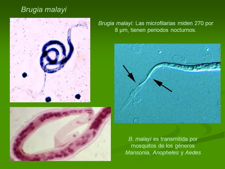 Brugia malayi Brugia malayi: Las microfilarias miden 270 por 8 µm, tienen periodos nocturnos.