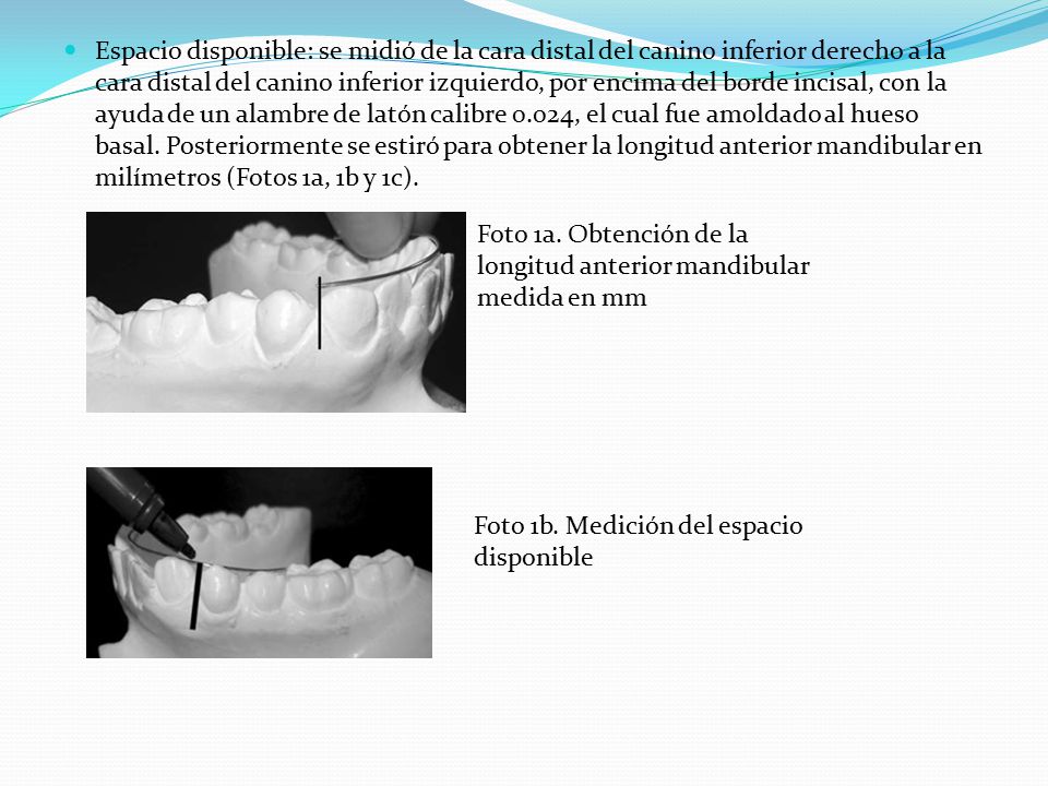 Espacio disponible: se midió de la cara distal del canino inferior derecho a la cara distal del canino inferior izquierdo, por encima del borde incisal, con la ayuda de un alambre de latón calibre 0.024, el cual fue amoldado al hueso basal. Posteriormente se estiró para obtener la longitud anterior mandibular en milímetros (Fotos 1a, 1b y 1c).