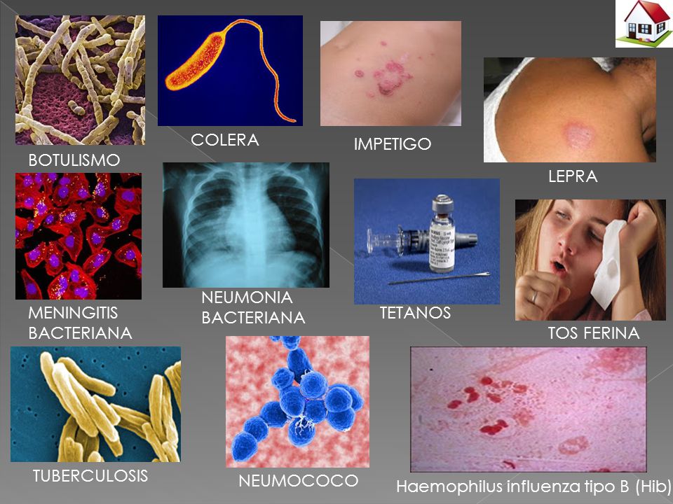 COLERA IMPETIGO. BOTULISMO. LEPRA. NEUMONIA BACTERIANA. MENINGITIS BACTERIANA. TETANOS. TOS FERINA.