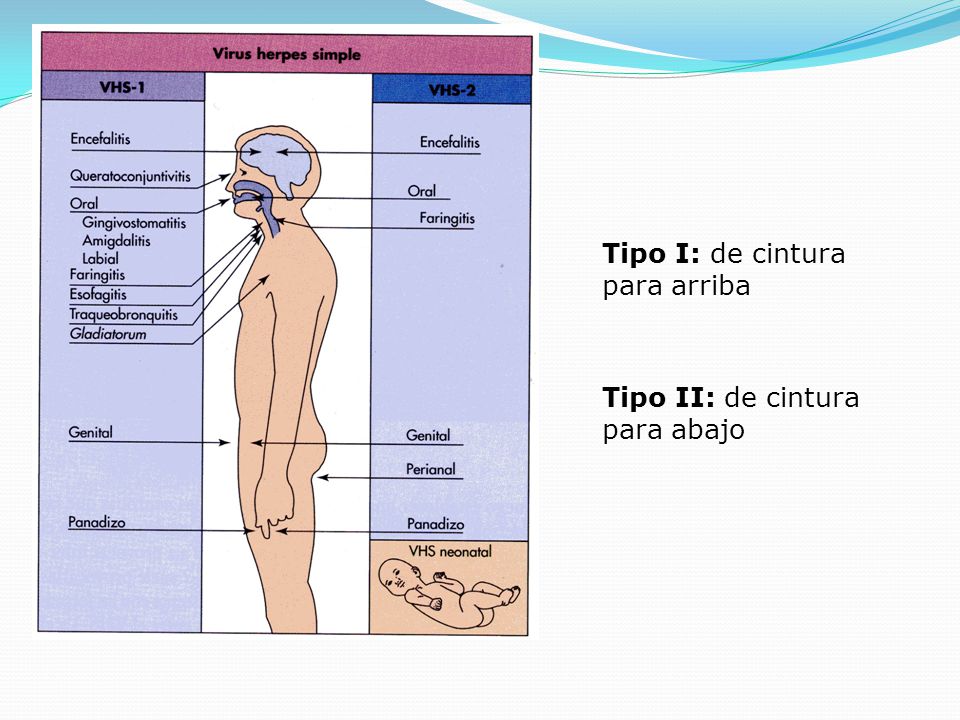 Tipo I: de cintura para arriba