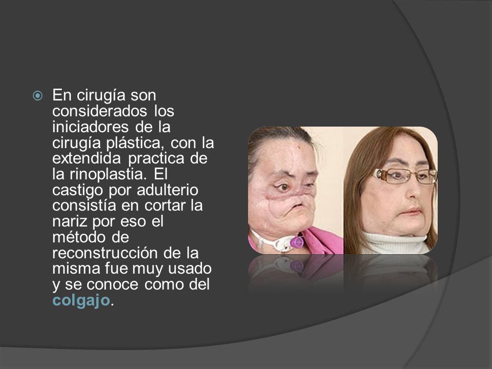 En cirugía son considerados los iniciadores de la cirugía plástica, con la extendida practica de la rinoplastia.