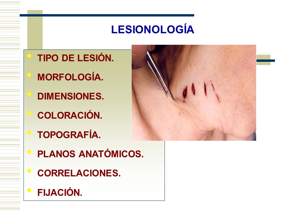 LESIONOLOGÍA TIPO DE LESIÓN. MORFOLOGÍA. DIMENSIONES. COLORACIÓN.