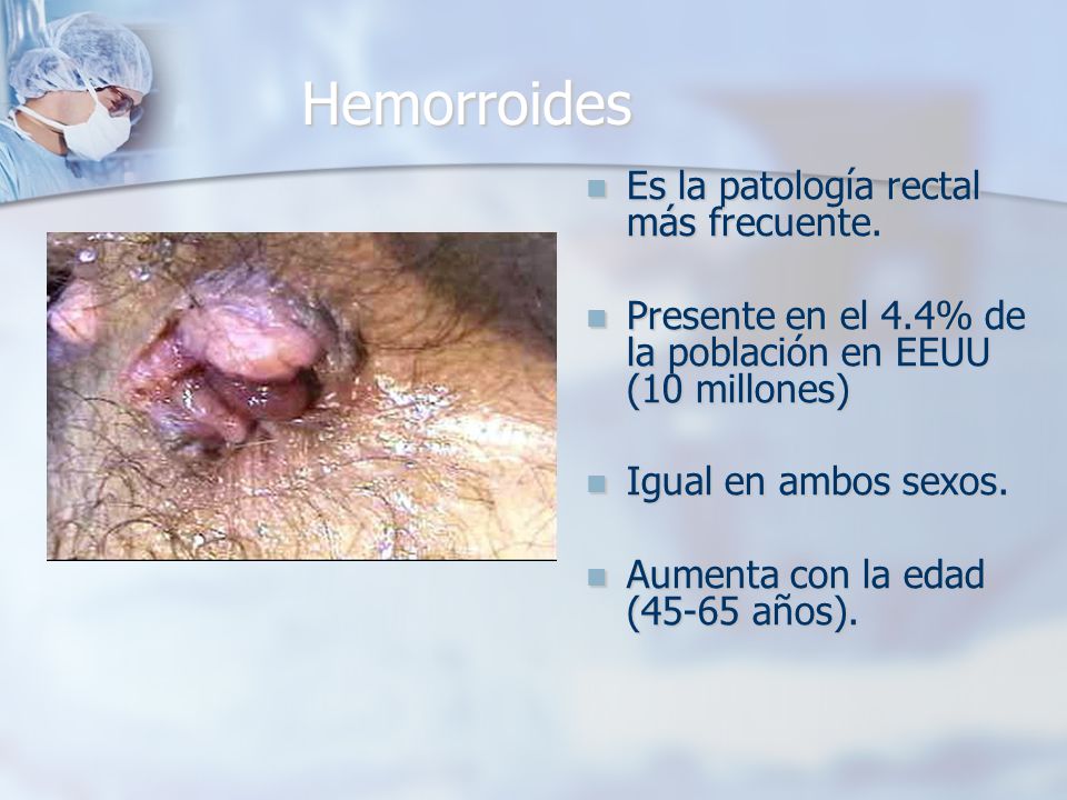 Hemorroides Es la patología rectal más frecuente.