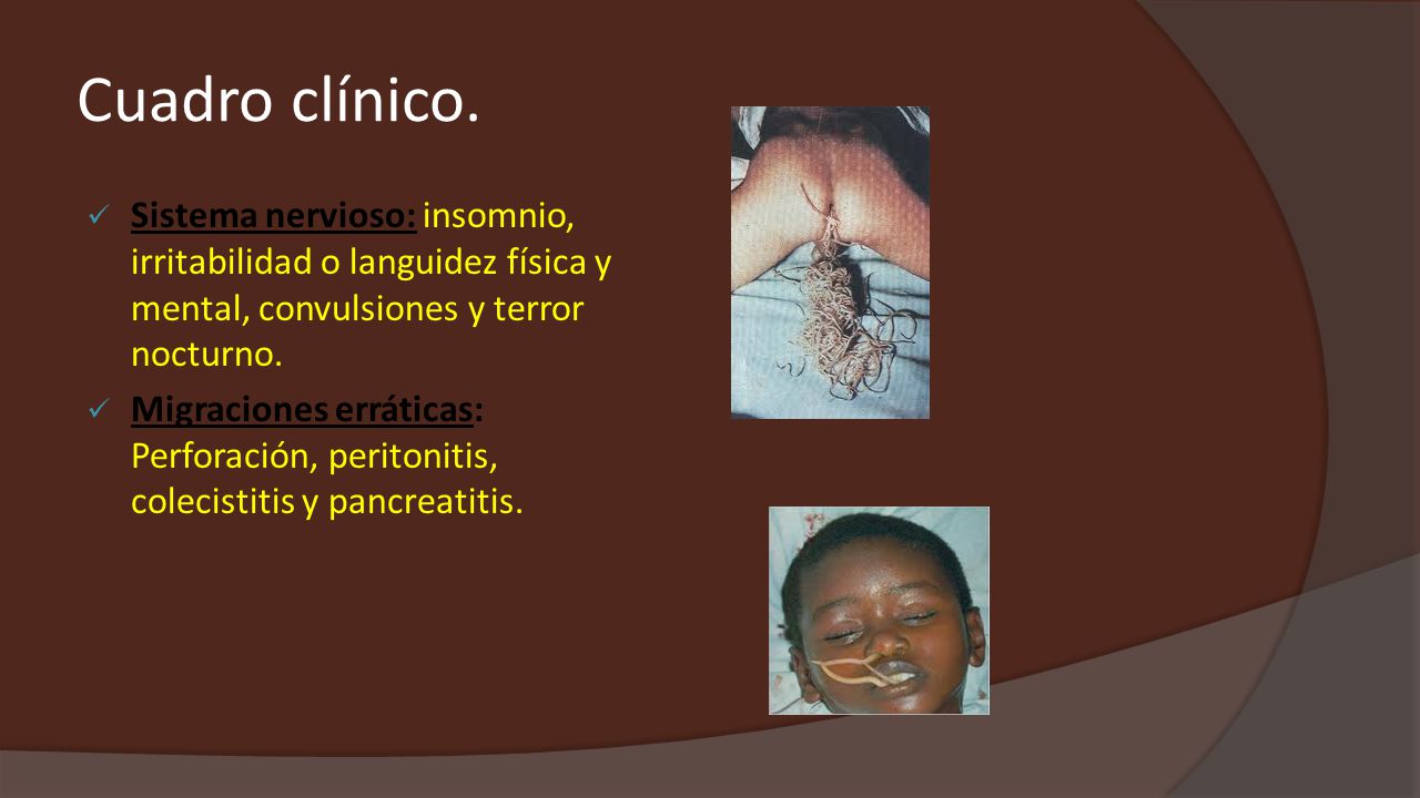 Cuadro clínico. Sistema nervioso: insomnio, irritabilidad o languidez física y mental, convulsiones y terror nocturno.
