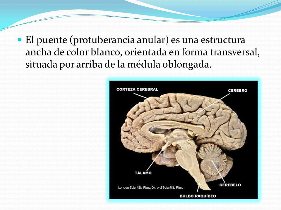 El puente (protuberancia anular) es una estructura ancha de color blanco, orientada en forma transversal, situada por arriba de la médula oblongada.
