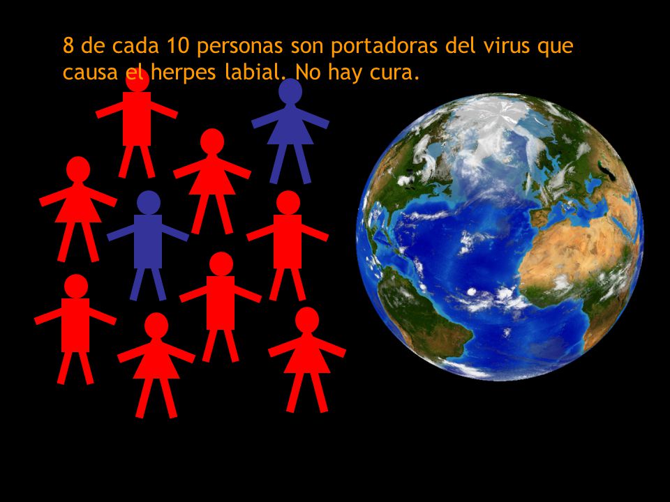 8 de cada 10 personas son portadoras del virus que causa el herpes labial. No hay cura.
