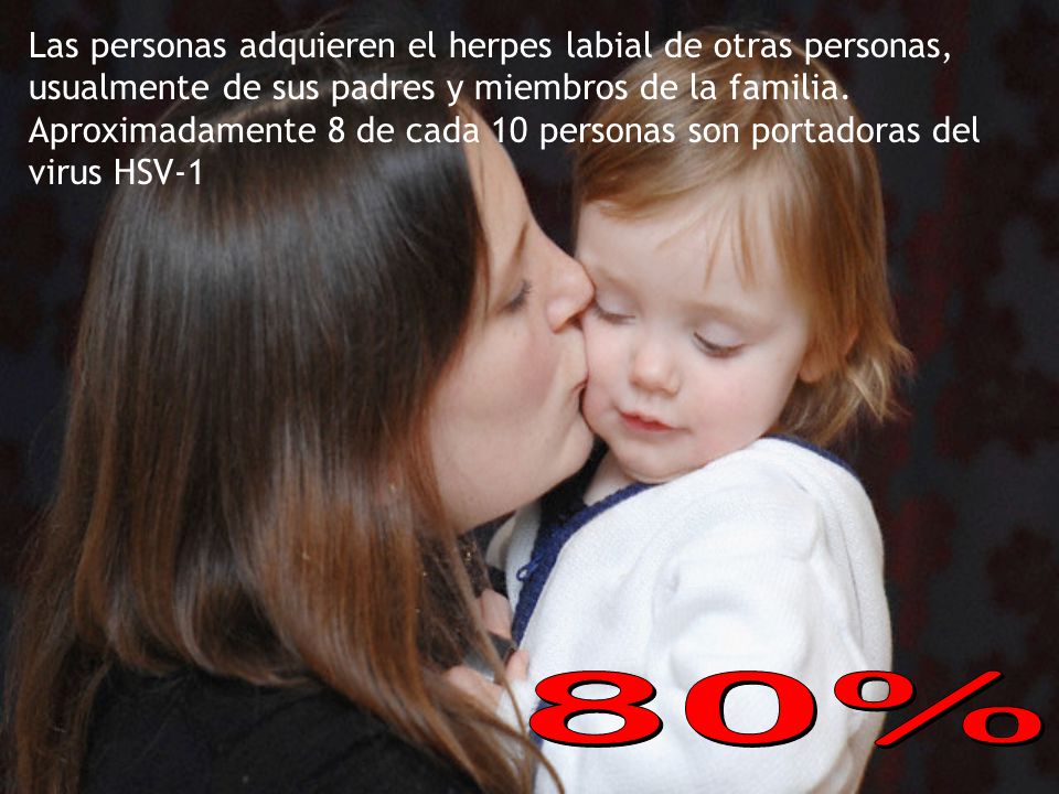 Las personas adquieren el herpes labial de otras personas, usualmente de sus padres y miembros de la familia. Aproximadamente 8 de cada 10 personas son portadoras del virus HSV-1