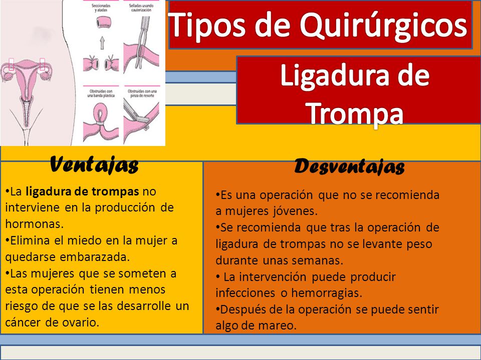 Metodos Anticonceptivos Ppt Video Online Descargar