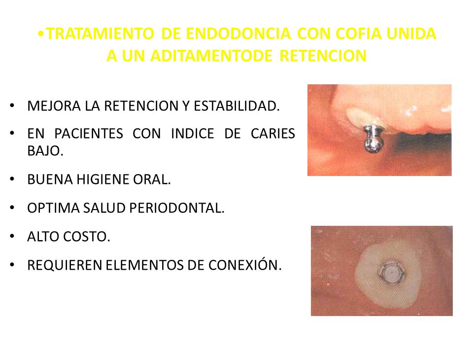 TRATAMIENTO DE ENDODONCIA CON COFIA UNIDA A UN ADITAMENTODE RETENCION