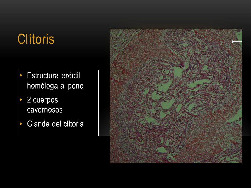 Clítoris Estructura eréctil homóloga al pene 2 cuerpos cavernosos
