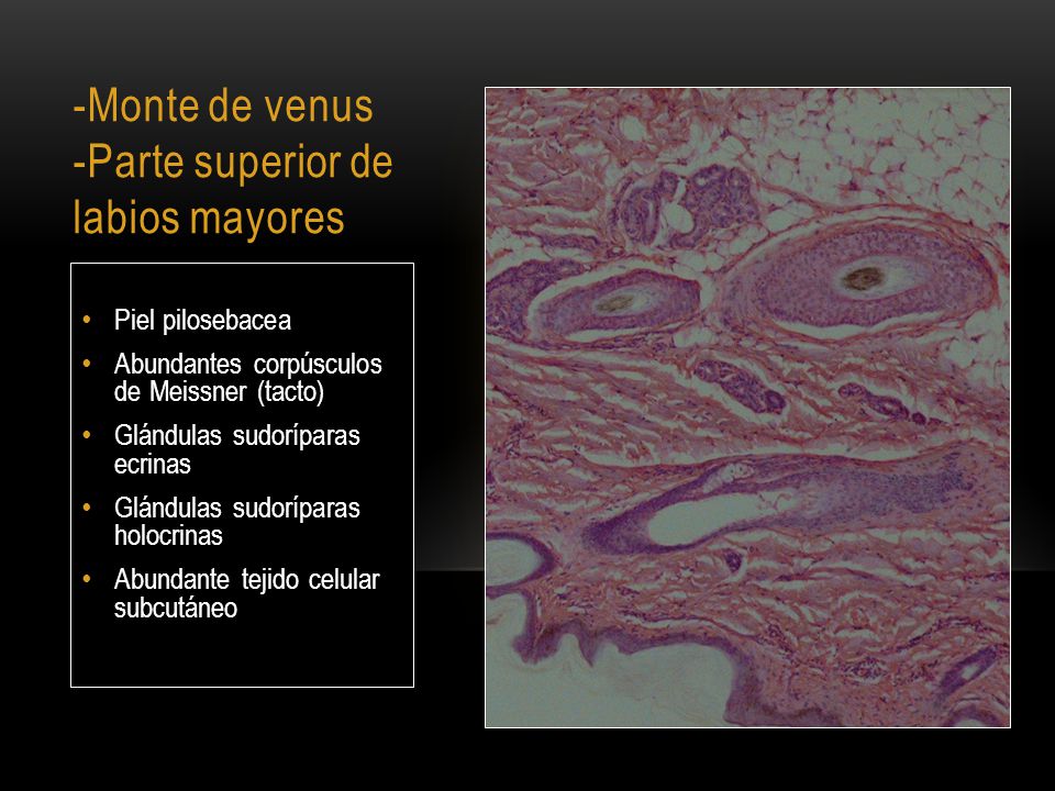 -Monte de venus -Parte superior de labios mayores