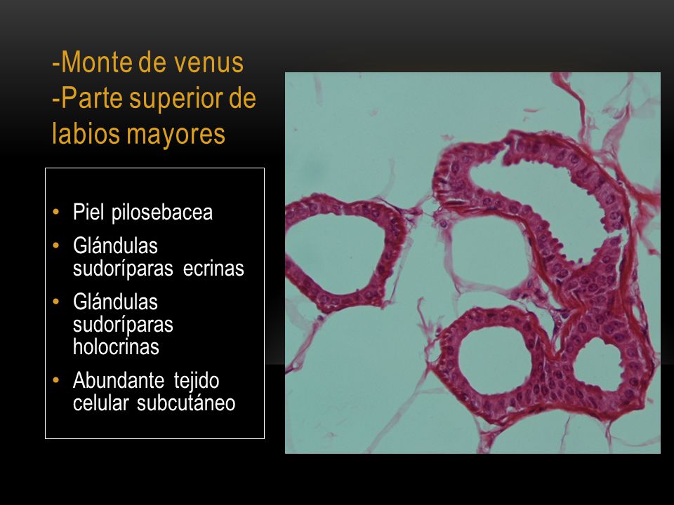 -Monte de venus -Parte superior de labios mayores