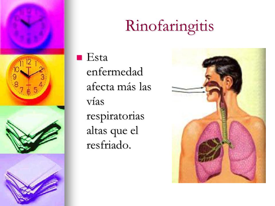 Rinofaringitis Esta enfermedad afecta más las vías respiratorias altas que el resfriado.