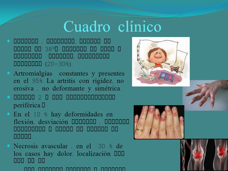 Cuadro clínico Astenia , anorexia, fiebre no mayor de 38°C perdida de peso y malestar general, debilidad muscular (20-30%).