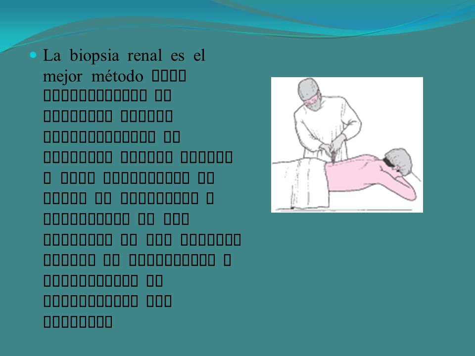 La biopsia renal es el mejor método para diagnosticar la nefritis lupica especialmente la nefritis lupica difusa y para determinar el grado de actividad o cronicidad de las lesiones ya que permite emitir un pronostico y seleccionar el tratamiento mas adecuado