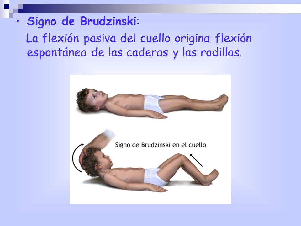 Signo de Brudzinski: La flexión pasiva del cuello origina flexión espontánea de las caderas y las rodillas.