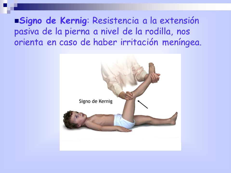 Signo de Kernig: Resistencia a la extensión pasiva de la pierna a nivel de la rodilla, nos orienta en caso de haber irritación meníngea.