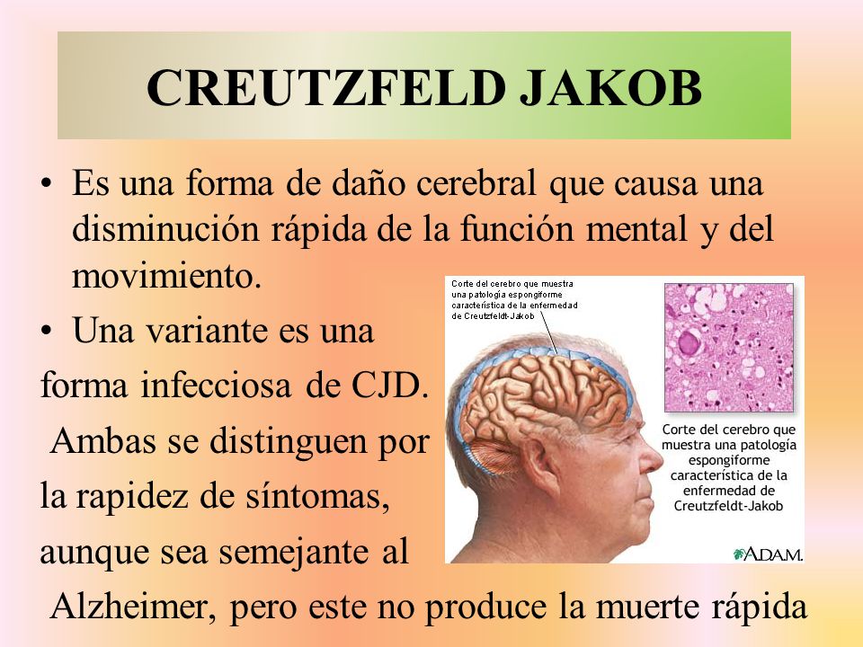 CREUTZFELD JAKOB Es una forma de daño cerebral que causa una disminución rápida de la función mental y del movimiento.