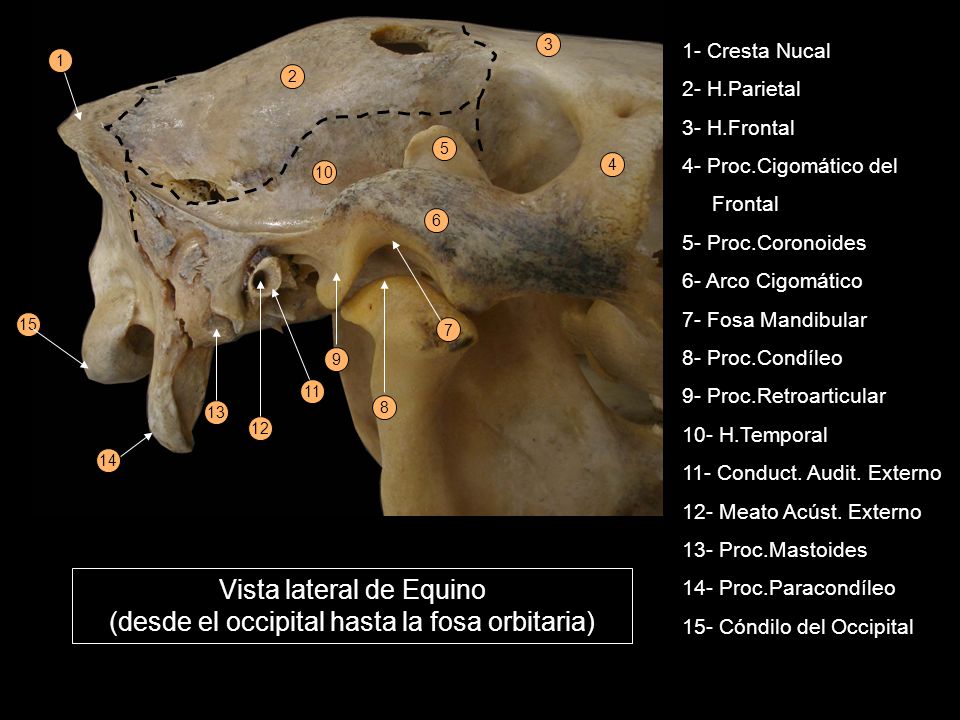 Vista lateral de Equino (desde el occipital hasta la fosa orbitaria)
