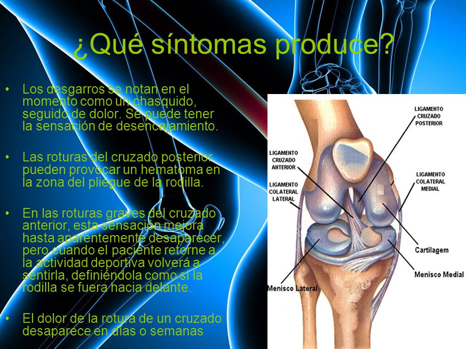 ¿Qué síntomas produce Los desgarros se notan en el momento como un chasquido, seguido de dolor. Se puede tener la sensación de desencajamiento.