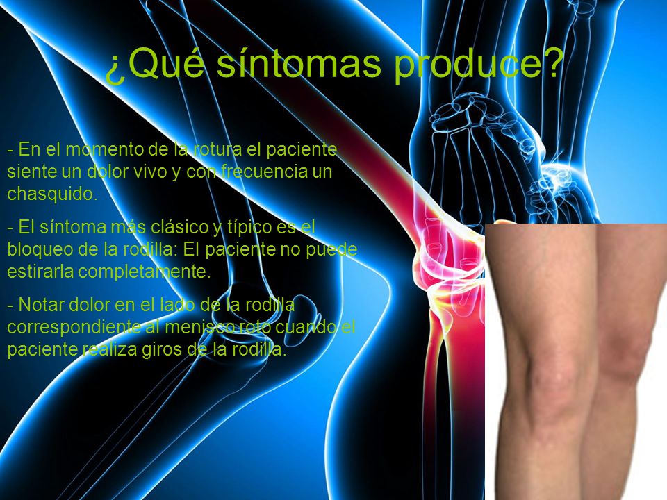 ¿Qué síntomas produce - En el momento de la rotura el paciente siente un dolor vivo y con frecuencia un chasquido.